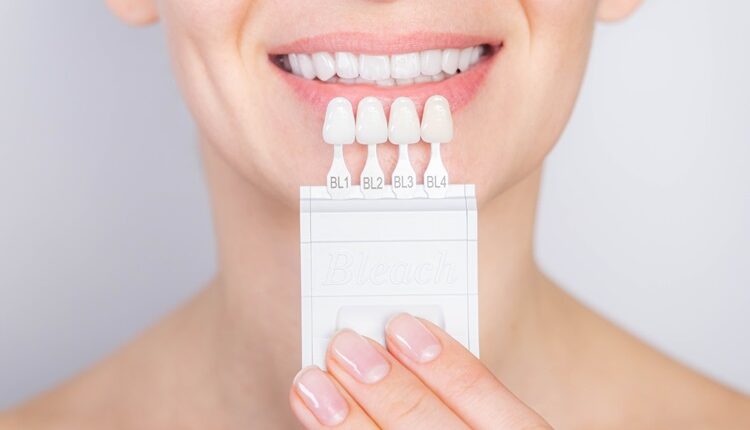 Teeth Whitening