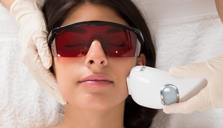 Laser Hair Removal